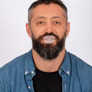 Kit Tratament Froggymouth L pentru vârsta peste 21 ani