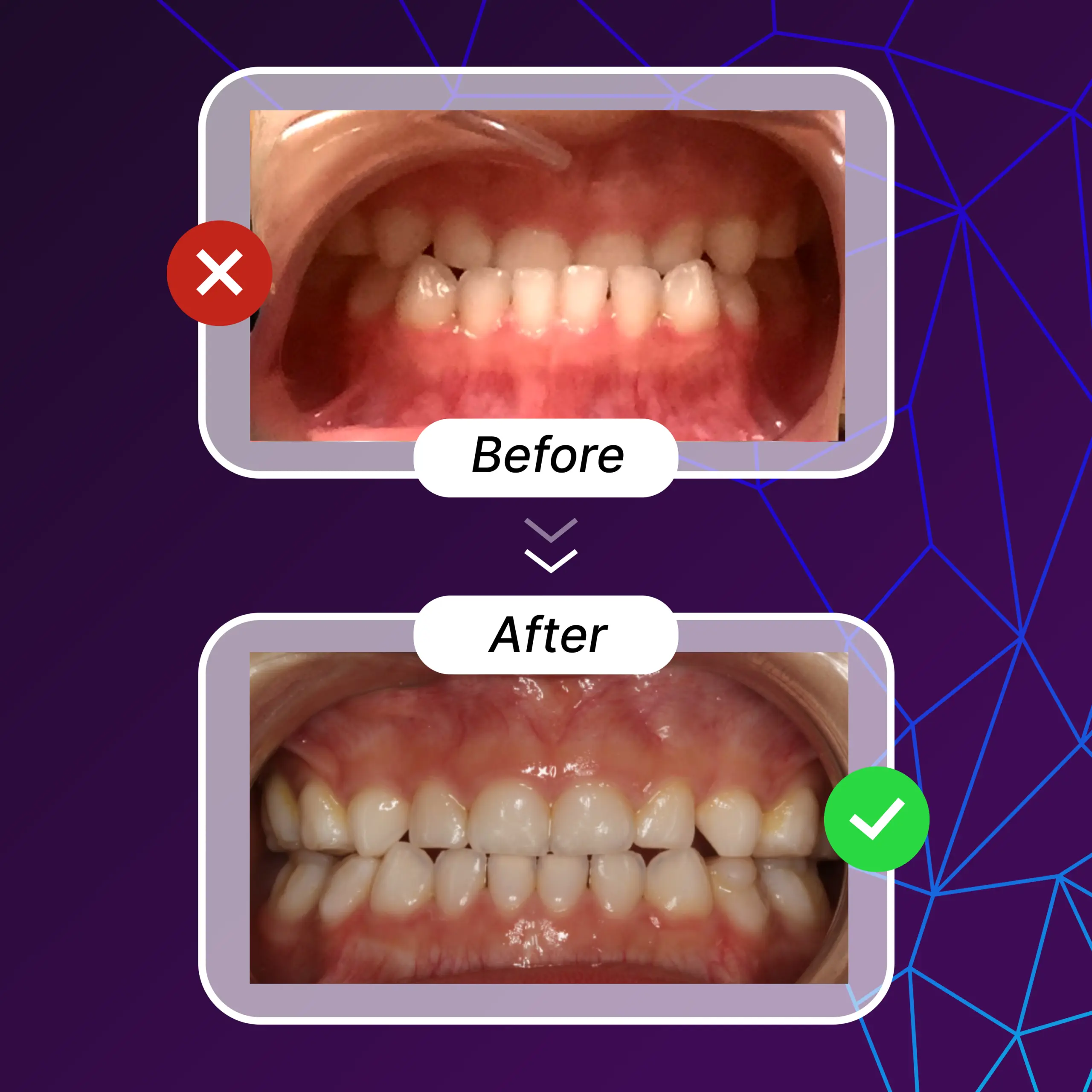 Pediatric Airways Focused Myofunctional Orthodontics - Dr. German